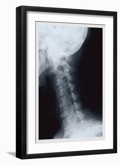 Neck-null-Framed Art Print