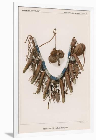 Necklace of Human Fingers-null-Framed Giclee Print
