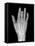 Needle Stuck In Hand, X-ray-Du Cane Medical-Framed Stretched Canvas