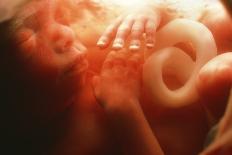 20 Week Old Foetus-Neil Bromhall-Photographic Print