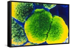 Neisseria Meningitis Bacteria-null-Framed Stretched Canvas