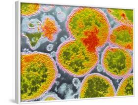 Neisseria Meningitis Bacteria-null-Framed Photographic Print