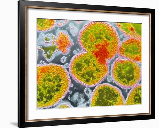 Neisseria Meningitis Bacteria-null-Framed Photographic Print