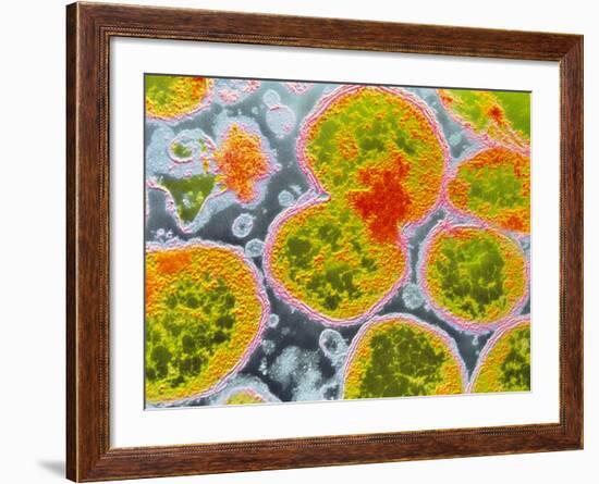 Neisseria Meningitis Bacteria-null-Framed Photographic Print