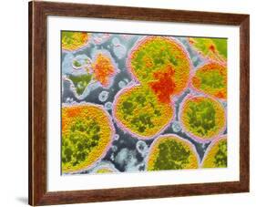 Neisseria Meningitis Bacteria-null-Framed Photographic Print