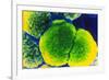 Neisseria Meningitis Bacteria-null-Framed Photographic Print