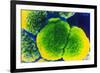 Neisseria Meningitis Bacteria-null-Framed Photographic Print