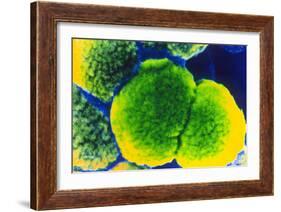 Neisseria Meningitis Bacteria-null-Framed Photographic Print