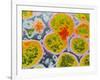 Neisseria Meningitis Bacteria-null-Framed Photographic Print