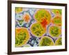 Neisseria Meningitis Bacteria-null-Framed Photographic Print