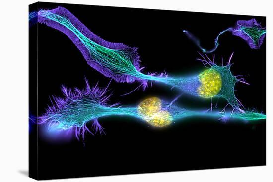 Nerve Cancer Cells, Light Micrograph-Dr. Torsten Wittmann-Stretched Canvas