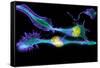 Nerve Cancer Cells, Light Micrograph-Dr. Torsten Wittmann-Framed Stretched Canvas