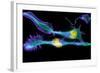 Nerve Cancer Cells, Light Micrograph-Dr. Torsten Wittmann-Framed Premium Photographic Print