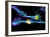 Nerve Cancer Cells, Light Micrograph-Dr. Torsten Wittmann-Framed Premium Photographic Print