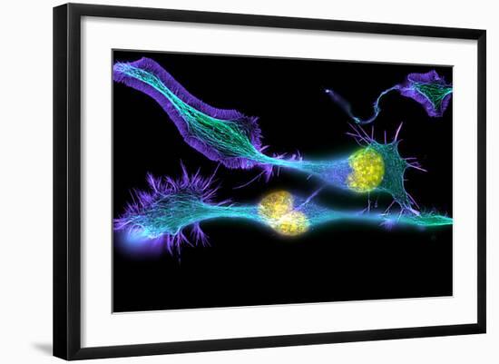 Nerve Cancer Cells, Light Micrograph-Dr. Torsten Wittmann-Framed Premium Photographic Print
