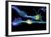 Nerve Cancer Cells, Light Micrograph-Dr. Torsten Wittmann-Framed Premium Photographic Print