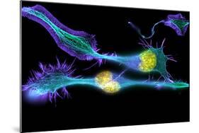 Nerve Cancer Cells, Light Micrograph-Dr. Torsten Wittmann-Mounted Premium Photographic Print