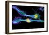 Nerve Cancer Cells, Light Micrograph-Dr. Torsten Wittmann-Framed Photographic Print