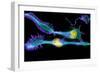 Nerve Cancer Cells, Light Micrograph-Dr. Torsten Wittmann-Framed Photographic Print