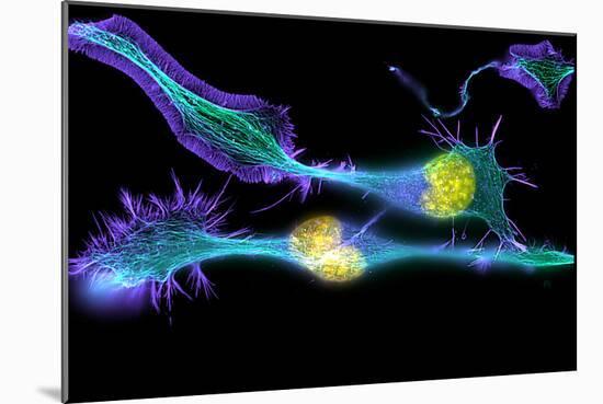 Nerve Cancer Cells, Light Micrograph-Dr. Torsten Wittmann-Mounted Photographic Print