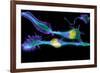 Nerve Cancer Cells, Light Micrograph-Dr. Torsten Wittmann-Framed Photographic Print