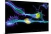 Nerve Cancer Cells, Light Micrograph-Dr. Torsten Wittmann-Mounted Photographic Print