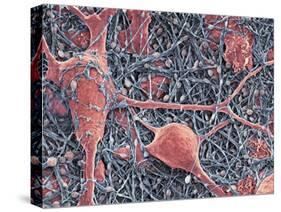 Nerve Cells And Glial Cells, SEM-Thomas Deerinck-Stretched Canvas