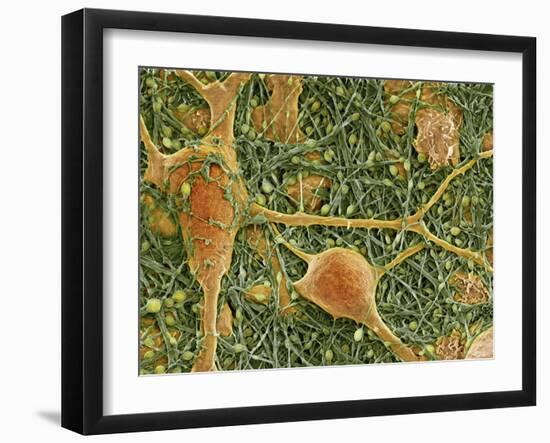 Nerve Cells And Glial Cells, SEM-Thomas Deerinck-Framed Photographic Print