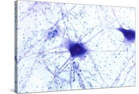 Nerve Cells, Light Micrograph-Steve Gschmeissner-Stretched Canvas