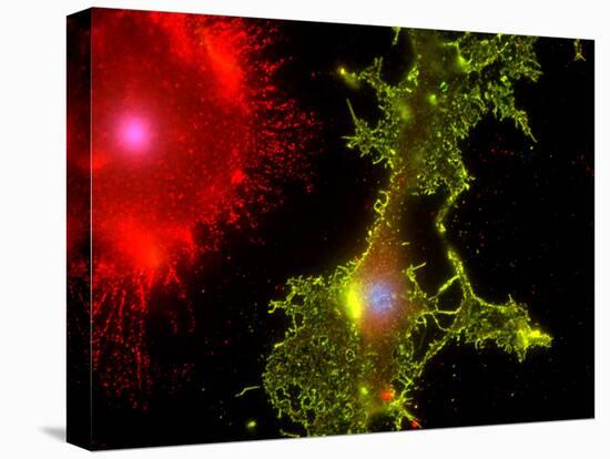 Nerve Cells-Riccardo Cassiani-ingoni-Stretched Canvas