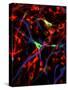 Nerve Cells-Riccardo Cassiani-ingoni-Stretched Canvas