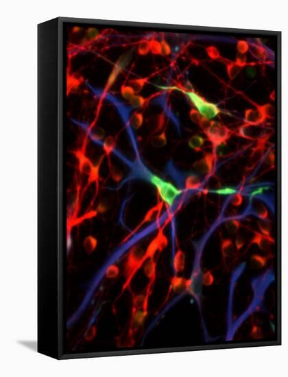 Nerve Cells-Riccardo Cassiani-ingoni-Framed Stretched Canvas