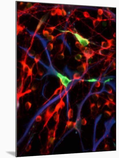 Nerve Cells-Riccardo Cassiani-ingoni-Mounted Photographic Print