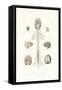 Nervous System, 1833-39-null-Framed Stretched Canvas