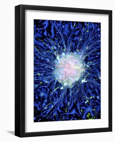 Neural Stem Cell Culture-Riccardo Cassiani-ingoni-Framed Photographic Print