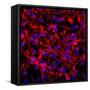 Neural Stem Cells In Culture-Riccardo Cassiani-ingoni-Framed Stretched Canvas