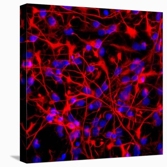 Neural Stem Cells In Culture-Riccardo Cassiani-ingoni-Stretched Canvas