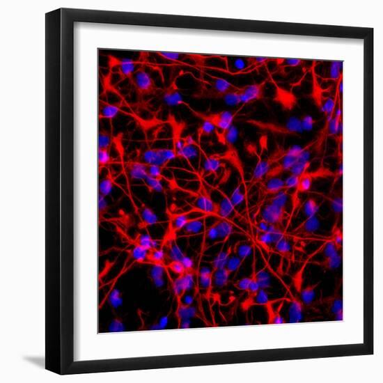 Neural Stem Cells In Culture-Riccardo Cassiani-ingoni-Framed Premium Photographic Print