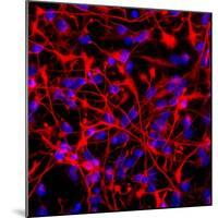 Neural Stem Cells In Culture-Riccardo Cassiani-ingoni-Mounted Premium Photographic Print
