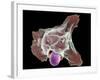 Neutrophil Engulfing Thrush Fungus, SEM-Science Photo Library-Framed Photographic Print