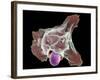 Neutrophil Engulfing Thrush Fungus, SEM-Science Photo Library-Framed Photographic Print