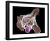 Neutrophil Engulfing Thrush Fungus, SEM-Science Photo Library-Framed Photographic Print