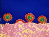 Coloured TEM of HIV Viruses Budding From a T-cell-NIBSC-Photographic Print