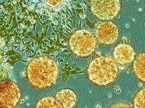Stem Cells, Light Micrograph-NIBSC-Photographic Print