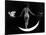 "Night", Nude Model, 1895-Science Source-Stretched Canvas