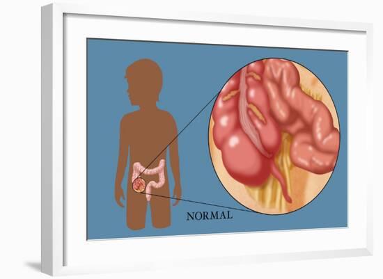 Normal Appendix-Monica Schroeder-Framed Giclee Print