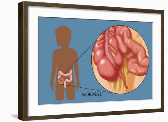 Normal Appendix-Monica Schroeder-Framed Giclee Print