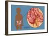 Normal Appendix-Monica Schroeder-Framed Giclee Print