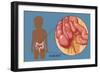 Normal Appendix-Monica Schroeder-Framed Giclee Print