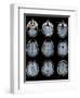 Normal Brain, MRI Scans-ZEPHYR-Framed Premium Photographic Print